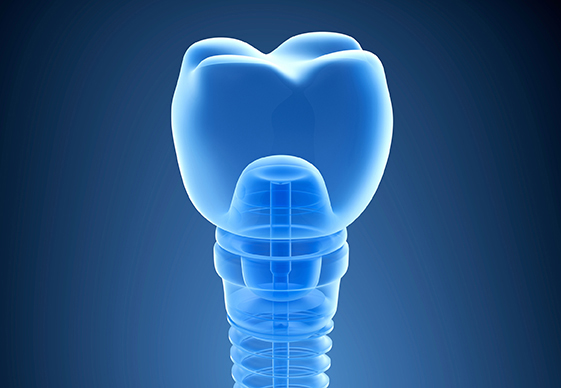 Implantología y Cirugía Oral